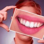 Hollywood Smile Abu Dhabi