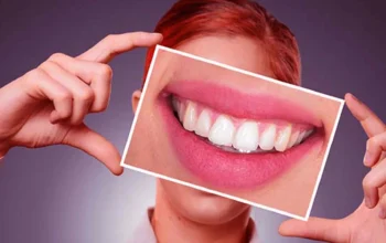 Hollywood Smile Abu Dhabi